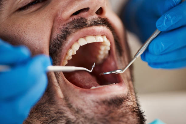 Best Emergency Dentist for Knocked-Out Tooth in Derry, PA